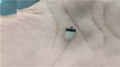 طبيب أنف وأذن بأسيوط ينتقد غش الطلاب: جالي العيادة 6 طلاب ثانوية عامة