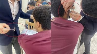 معيد حقوق جامعة أسيوط يروي تفاصيل واقعة استخراج سماعة غش بملقاط